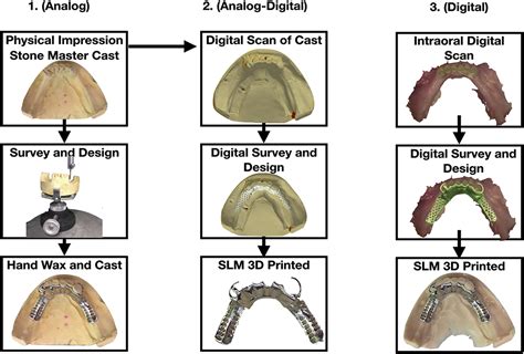 fabrication process of a cast metal partial denture ppt|how to make a denture.